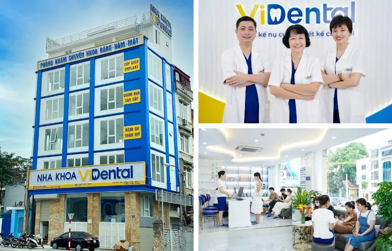 Review Nha Khoa Lê Hưng Đống Đa Có Tốt Không Và Những Lưu Ý Cần Biết Review Nha Khoa Lê Hưng Đống Đa Có Tốt Không Và Những Lưu Ý Cần Biết