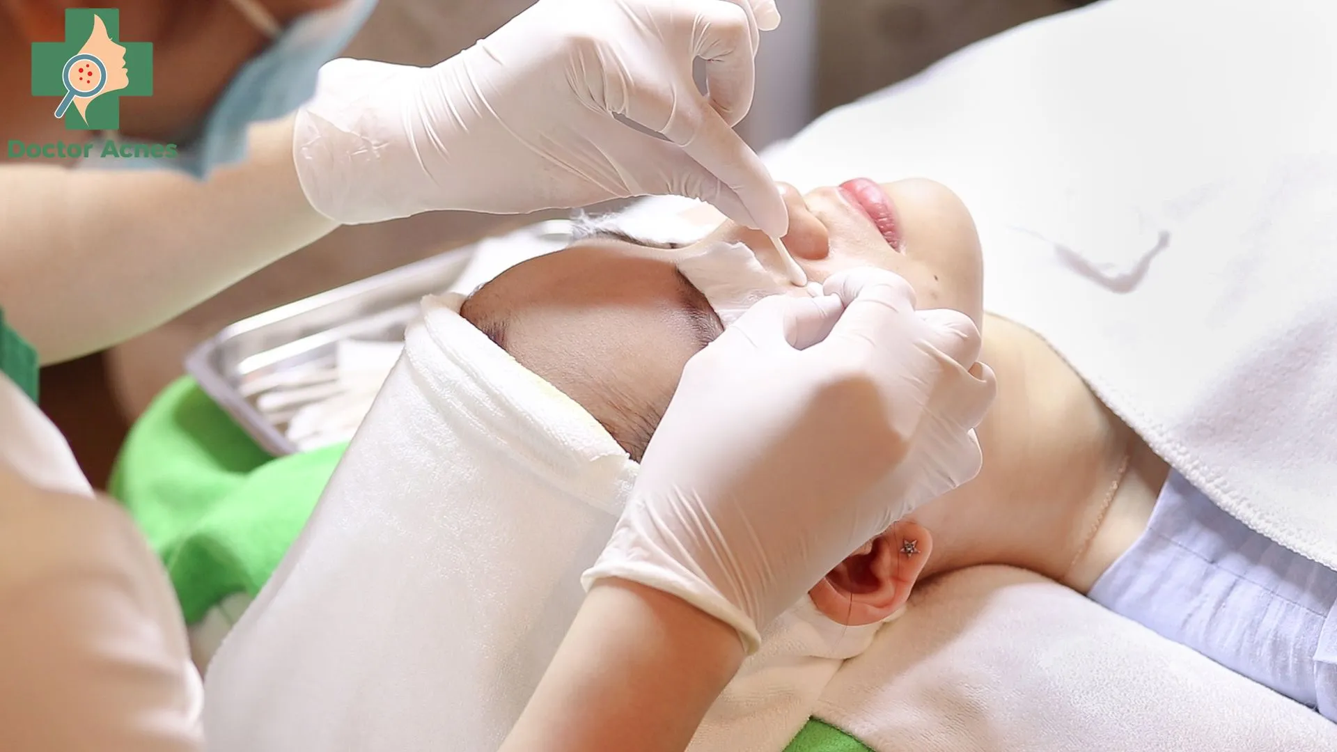 Quy trình lấy nhân mụn chuẩn y khoa đảm bảo vệ sinh và hiệu quả tại spa