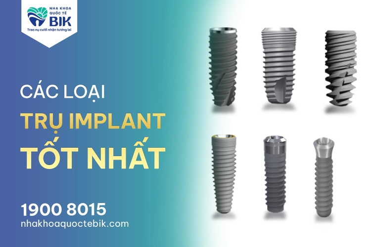 cac-loai-tru-implant-tot-nhat Cấu tạo chi tiết của một bộ Implant bao gồm trụ khớp nối và mão răng sứ