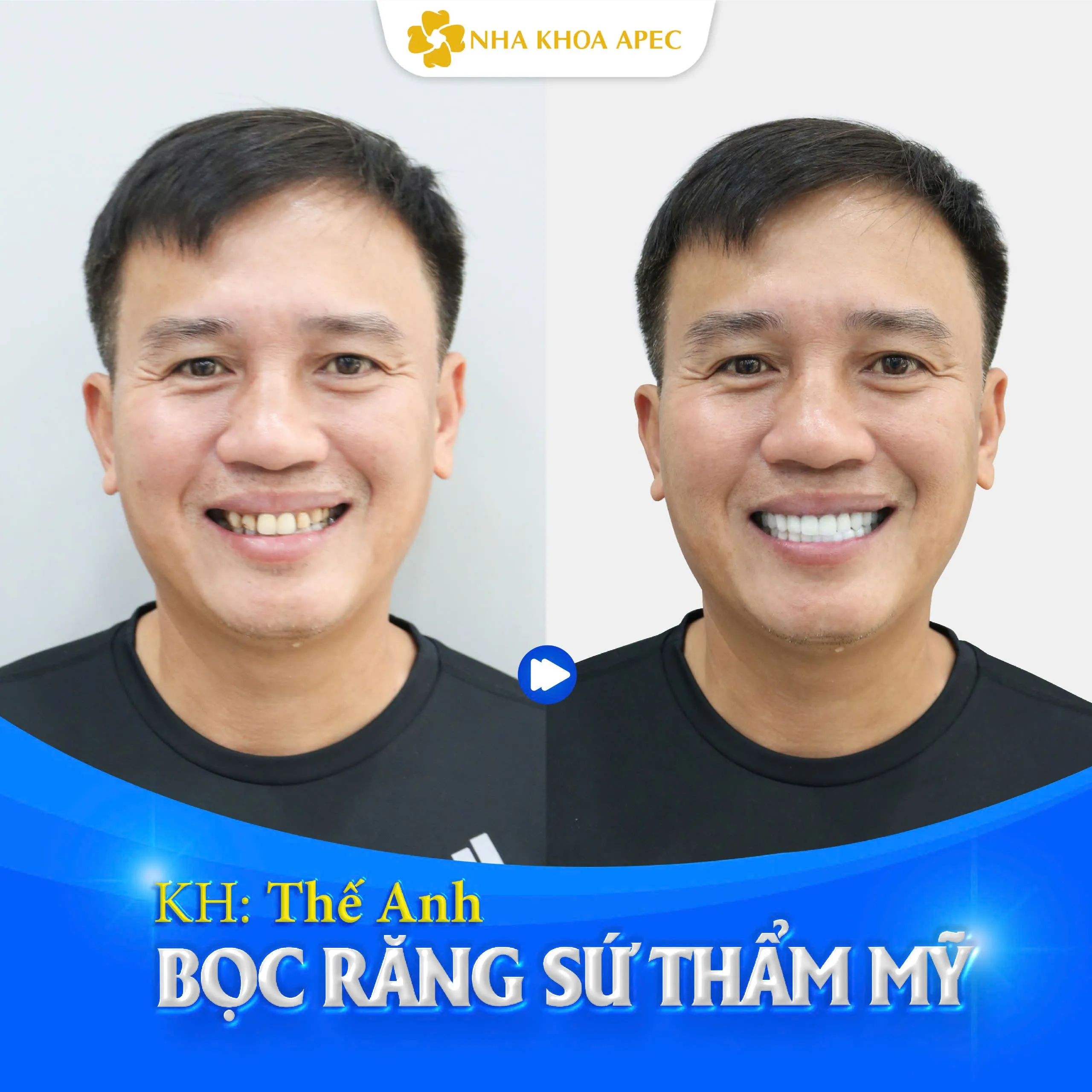 Sự hài lòng của khách hàng là minh chứng cho chất lượng dịch vụ tại Nha khoa Paris