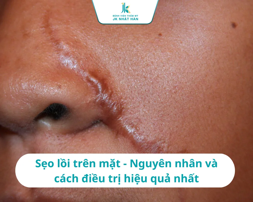 Sử dụng đúng loại thuốc giúp làm phẳng và mờ các vết sẹo lồi cứng đầu