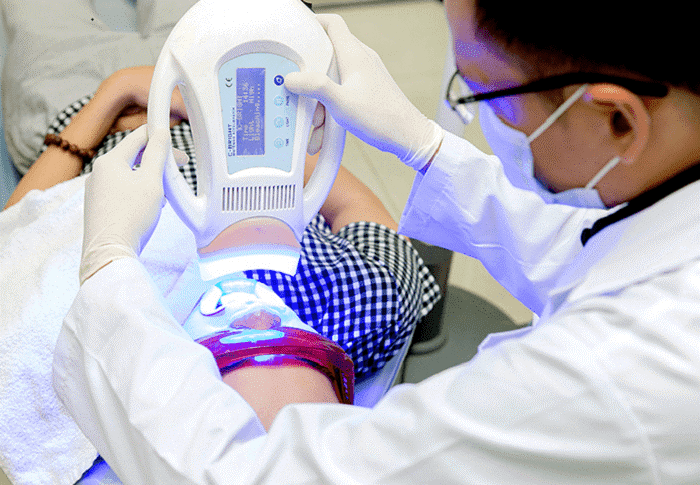 tay-trang-rang-laser-whitening Kỹ thuật chiếu đèn Laser giúp kích hoạt thuốc tẩy trắng một cách nhanh chóng và an toàn
